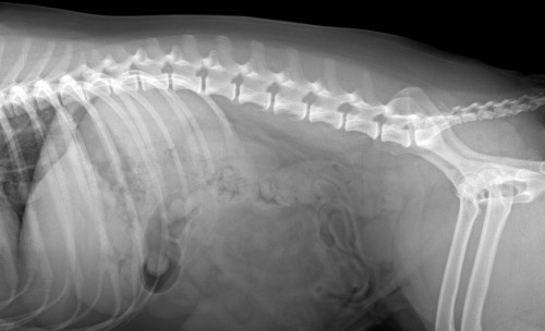 after bladder stone surgery