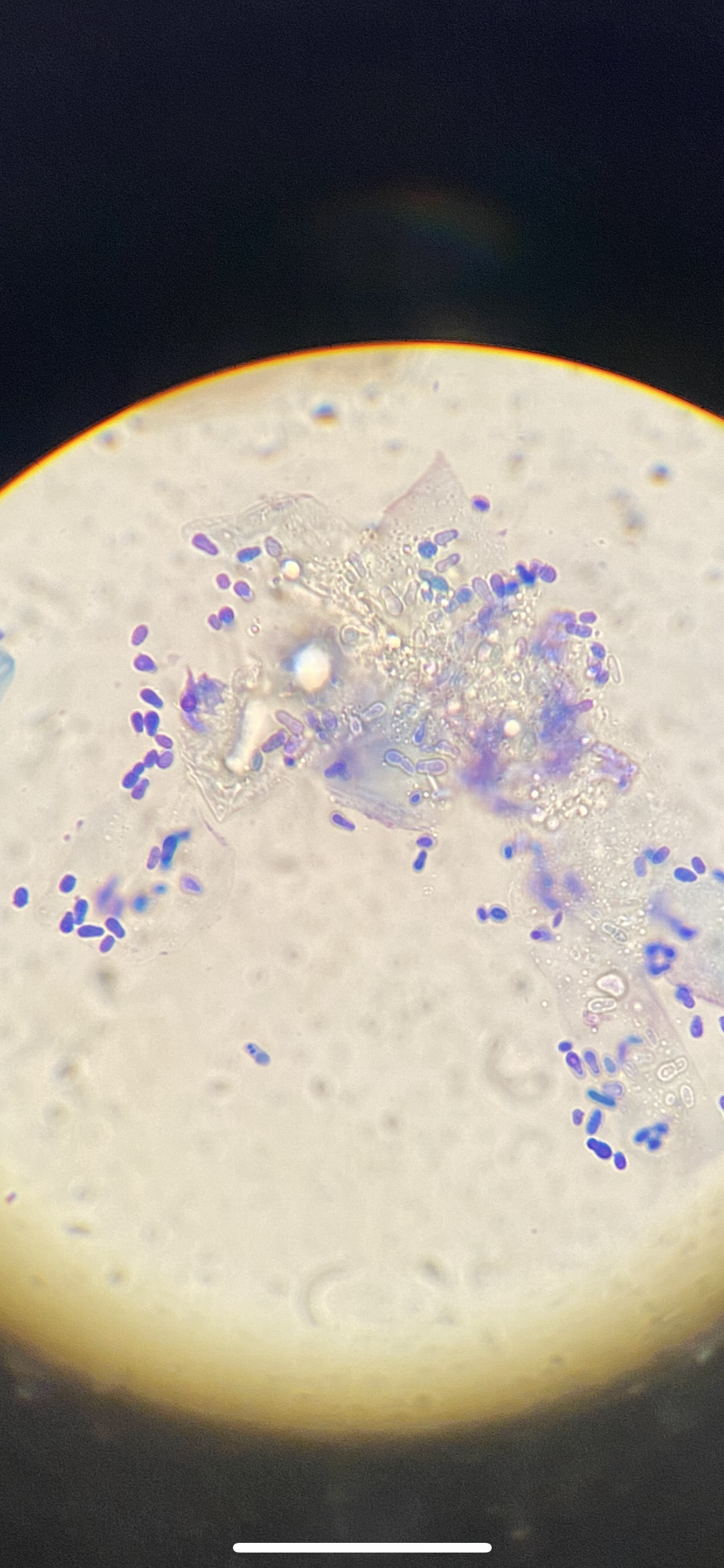 Malasezzia yeast from a dog ear infection