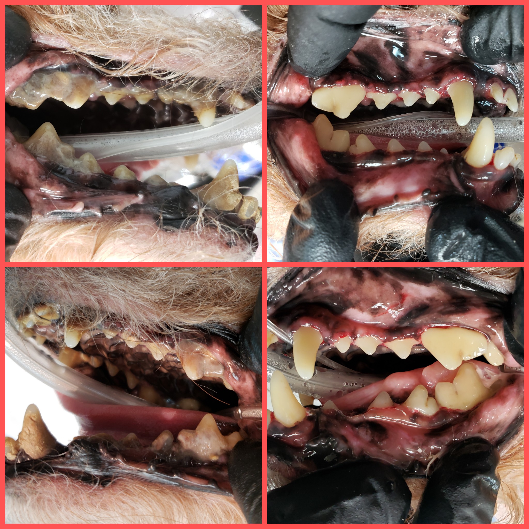 PMC Dental Care Before and After Cleaning