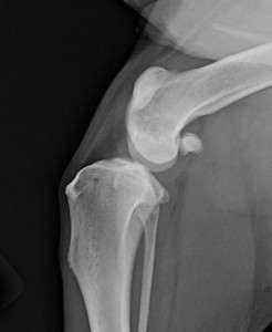 medial-patellar-luxation-mpl-1.png