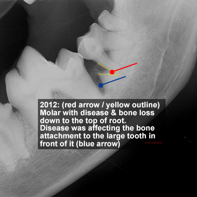 XRay showing severe dental disease and bone loss