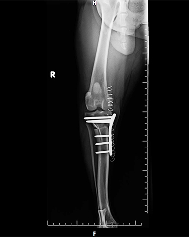 Tibial Plateau Leveling Osteotomy (TPLO) X-ray