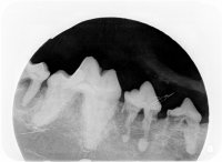 Digital Dental- Abnormal Roots